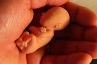 علل اصلی سقط جنین در ماه‌های مختلف بارداری