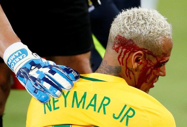 آسیب دیدگی نیمار مهاجم برزیلی در دیدار برابر بولیوی. این بازی با پیروزی پنج بر صفر سلسائو به پایان رسید.