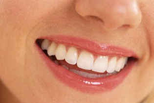 دندان‌هایتان را در خانه جرمگیری طبیعی كنید