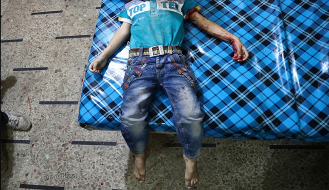 پیکر کودک قربانی جنگ در شهر "دوما" سوریه. اکتبر 2016