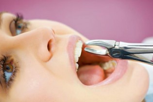 زمان مناسب برای جراحی دندان عقل