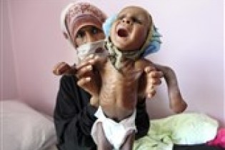 شهادت ۱۴۰۰ کودک یمنی از ابتدای تجاوز سعودی تاکنون