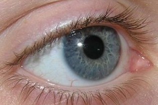 با دیدن این علائم در چشم ها باید به سرطان شک کرد!