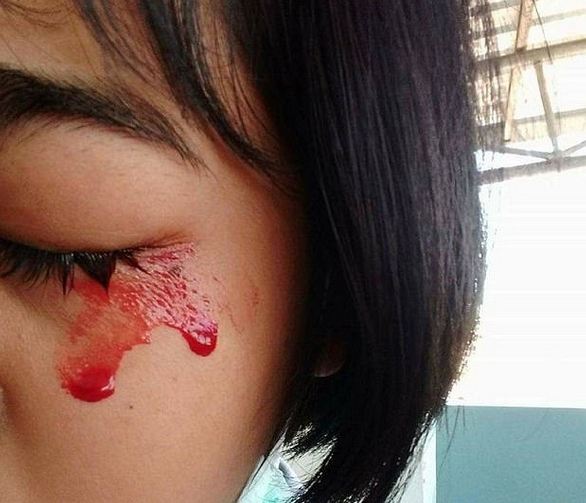 جاری شدن خون از چشم و دست دختر تایلندی