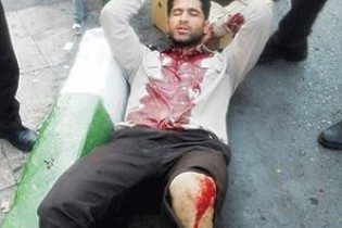 حمله خونین دستفروشان به یک شهربان شهرداری