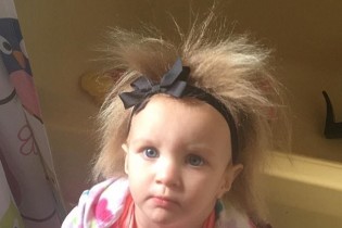 دختربچه دو ساله ای که عجیب ترین موها را دارد + تصاویر