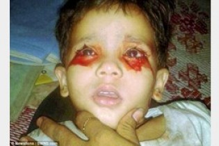 دختری که خون گریه می کند+ تصاویر