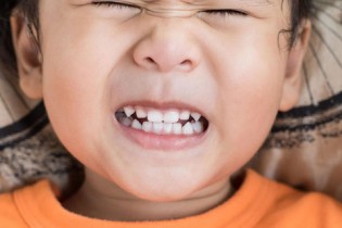 راه های درمان دندان قروچه را بخوانید