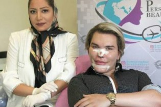 رکورددار جراحی زیبایی برای عمل بینی به ایران آمد