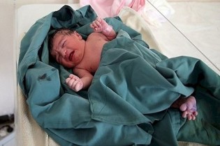 تولد نوزادی در هند که جنینی در شکم داشت