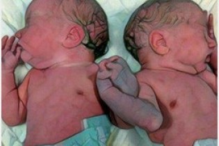 سرنوشت دردناک دوقلو های نوزاد در بندرعباس