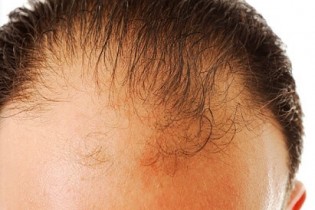 نوع شامپو تاثیر چندانی در جلوگیری از ریزش مو ندارد