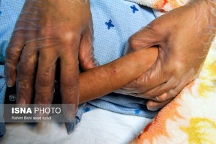 تصاویر / وضعیت ابوالفضل کوچولو پس از شکنجه ناپدری