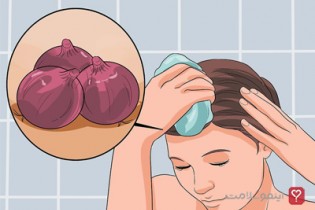 چند راهکار برای جلوگیری از ریزش مو در زنان
