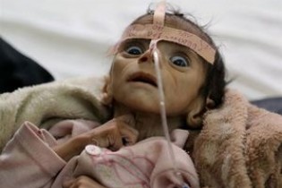 هشدار سازمان بهداشت جهانی نسبت به موج جدید «وبا» در یمن