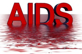 درمان ایدز با کمک طب سنتی