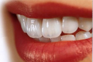6 ماده طبیعی و موثر خانگی که برای جرم گیری دندان موثرند