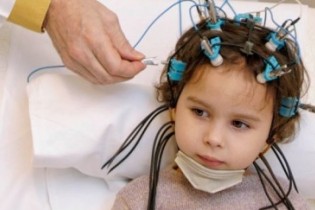 احتمال بروز سکته مغزی در بین کودکان