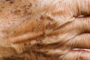 چگونه با بالا رفتن سن از پیری پوست جلوگیری کنیم؟