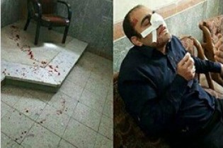پدر دانش آموزی آقا معلم را در کلاس درس کتک زد/  دستگیری ضارب معلم حمیدیه + عکس