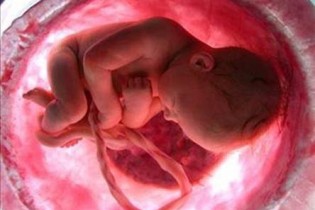 فریز تخمک و اسپرم برای حفظ باروری دختران و پسران مجرد + جزییات