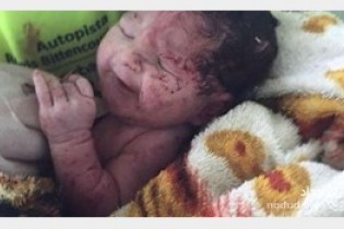 لحظه عجیب تولد نوزاد از شکم مادرش بعد از تصادف