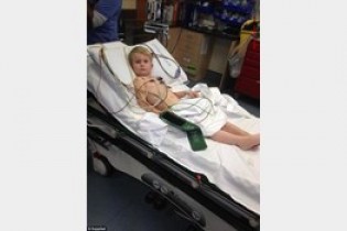 پسر بچه‌ خوش شانس از دست مار کشنده نجات یافت