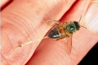 درمان اگزما با کمک زنبورها