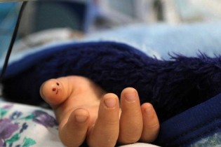 مرگ کودک 7 ساله پس از تزریق آمپول در یزد