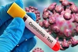 مورد جدید کروناویروس در استان مرکزی مشاهده نشده/نتیجه آزمایش بیمار فوتی ساوجی دریافت نشده
