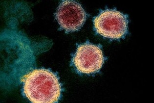 تفکیک آنفلوانزا و کرونا؛ نگرانی اصلی برای فصل زمستان