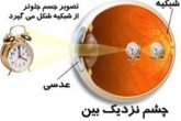 شیوع نزدیک‌بینی در بین ایرانیان