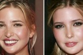 تصاویر/ ایوانکا ترامپ قبل و بعد از جراحی زیبایی!