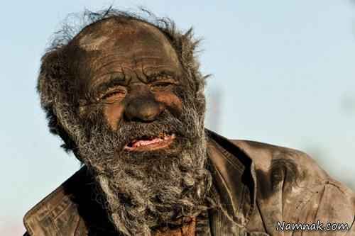 تصاویر/ کثیف ترین مرد ایرانی که 60 سال حمام نرفته است