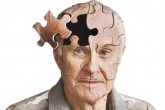 توصیه های  یک متخصص تغذیه برای مبتلایان به آلزایمر