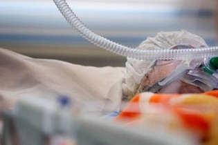 فوت ۶۲ بیمار مبتلا به کرونا در شبانه‌روز گذشته