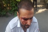 ضرب و شتم نیروی اورژانس تهران به دلیل پلاک نداشتن آمبولانس!